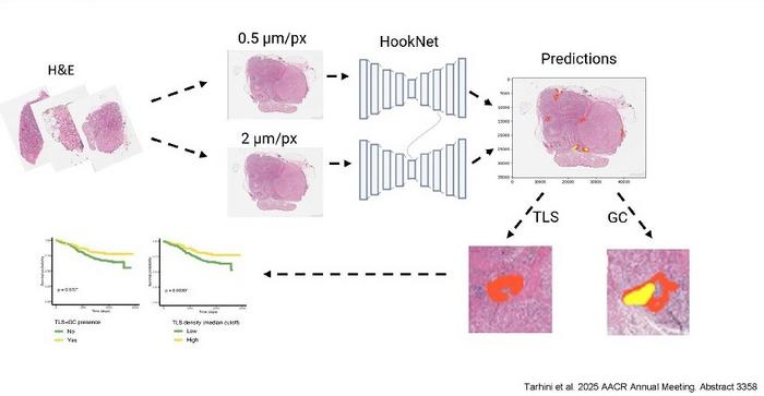 AI Destekli Immün Hücre Analizi ile İleri Melanomda Sağkalım Tahmini