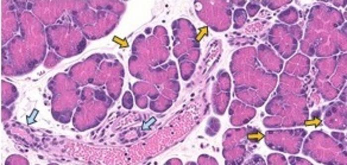 Kanser Öncesi Epigenetik İzleri Taıyan Pankreas Hücreleri Genetik Mutasyonlar İçermiyor