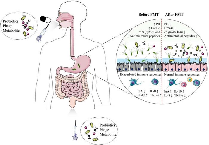 Fekal Mikrobiyota Transplantasyonunda Umut Verici Gelişmeler