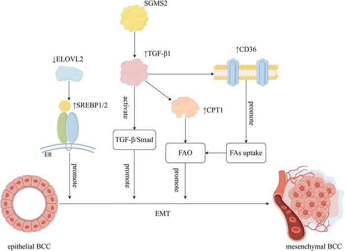 Lipid Metabolizmasının Meme Kanseri İlerlemesi ve Tedavi Direncine Etkileri