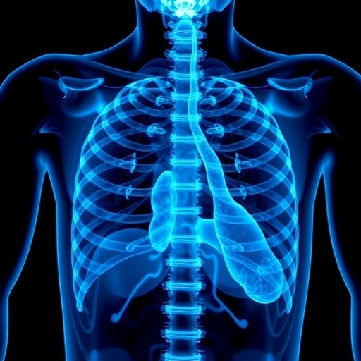 Yeni Özofagus Kanseri Tedavisinde Camrelizumab, Apatinib ve İrinotekan Kombinasyonu