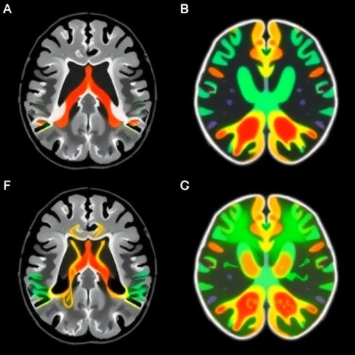 7T Mri Connectivity Enhances Parkinsons Dbs Targeting 1779973961
