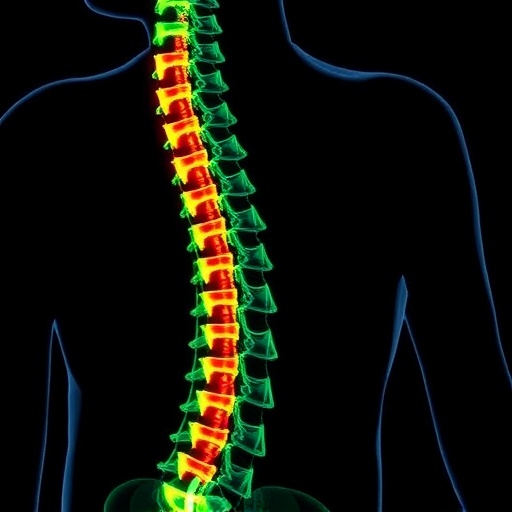 Anti Nogo A Treatment Alters Spinal Cord Structure Post Injury 1778640927
