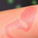 Bacterial Lipopeptides Block Il 33 Release Easing Dermatitis 1778681188