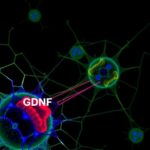 Blocking Gdnf Production In Schwann Cells Could Alleviate Pain In Nf1 1779827921
