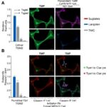 Blocking Tgm2 Boosts Cisplatin Response In Msh2 Deficient Bladder Cancer 1779981328
