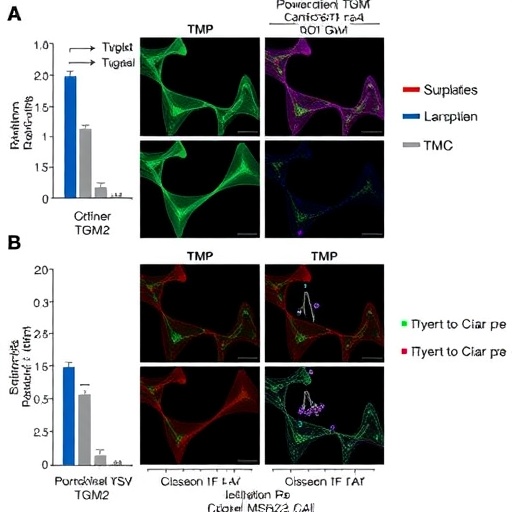 Blocking Tgm2 Boosts Cisplatin Response In Msh2 Deficient Bladder Cancer 1779981328