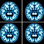 Clear Dess Mri Boosts Parkinsons Diagnosis At 7T 1779966629