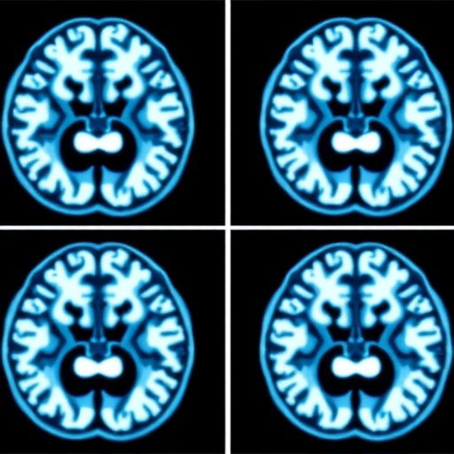Clear Dess Mri Boosts Parkinsons Diagnosis At 7T 1779966629