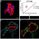 Cpt1B K321 Crotonylation Drives Heart Dysfunction In Shock 1779991970