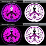 Carboplatin ± Nivolumab In Metastatic Tnbc Trial 1778898149