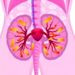 Deadly Urothelial Cancer Linked To Myc Overexpression 1778871516
