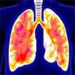 Expert Diffusion Model Predicts Localizes Lung Cancer Stas 1779918804