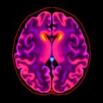 Gaba Dysfunction In Parkinsons Revealed By Mri 1779816462