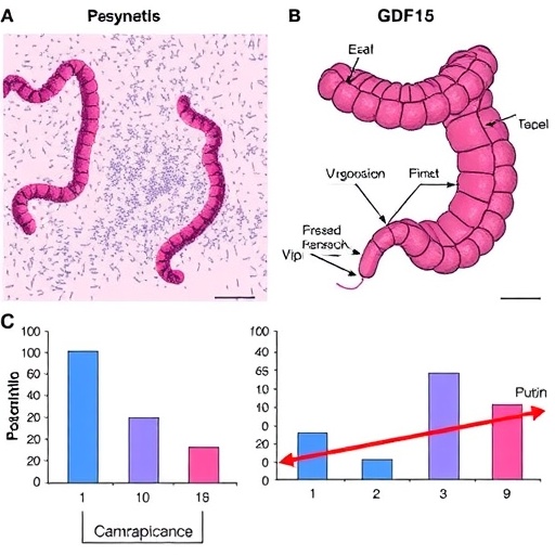 Gdf15 Drives Chemotherapy Resistance In Colorectal Cancer 1778618488