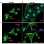 Gpsm1 Limits Cd73Cd103 Tregs Driving Obesity Damage 1779753748