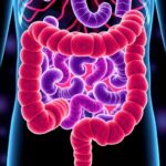 Gut Microenvironment Reprogrammed To Treat Severe Ulcerative Colitis 1778673865