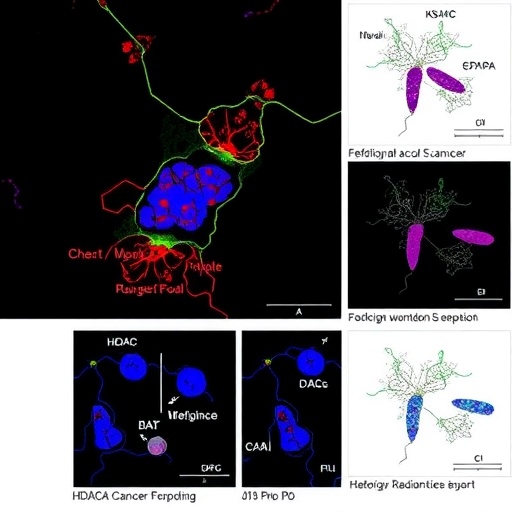 Hdac4 Protac Boosts Lung Cancer Ferroptosis Sensitizes Radiation 1779750095