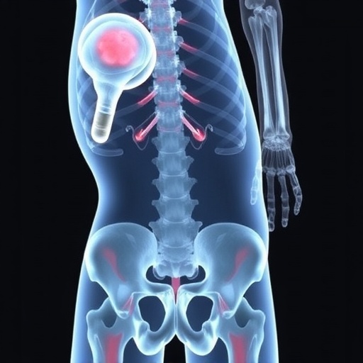 High Fructose Diet Drives Osteoporosis Via Cholesterol 1778011165