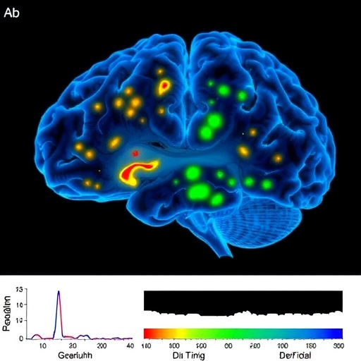 Human Oligodendrocyte Polarization Post Severe Brain Injury 1779929795
