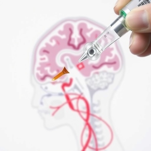 Intravenous Tenecteplase Administered Before Endovascular Therapy Shows Promise For Ischemic Stroke Patients Within 4.5 To...