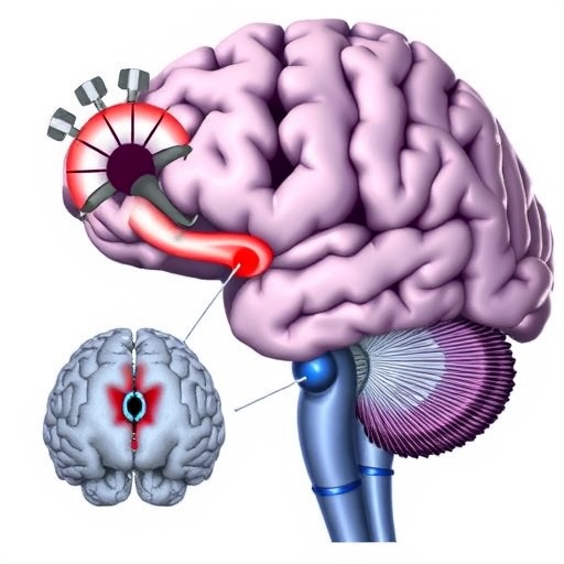 Language Plasticity In Anaesthetized Human Hippocampus 1778098655