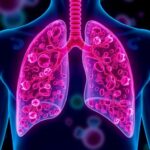 Lung Cancer Cells Change Identity To Evade Treatment Resistance 1779906208