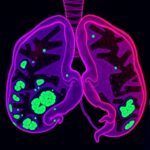 Mark2 The Key Protector Of Mutant P53 In Aggressive Breast Cancer 1779820223