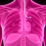 New Study Sheds Light On Predicting Chemotherapy Response In Triple Negative Breast Cancer 1778686589