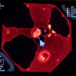 Pembrolizumab And Lenvatinib Trial For Mucosal Melanoma 1778901813