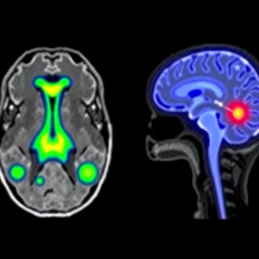 Personalized Ai Guided Radiation Boosts Glioblastoma Treatment 1778707223