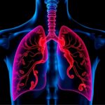 Reevaluating Surgery Eligibility For Lung Cancer Patients Who Smoke 1779998977