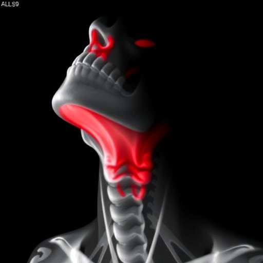 Successful Treatment Of Rare Laryngeal Leiomyosarcoma Using Surgery And Adjuvant Chemotherapy 1778700208
