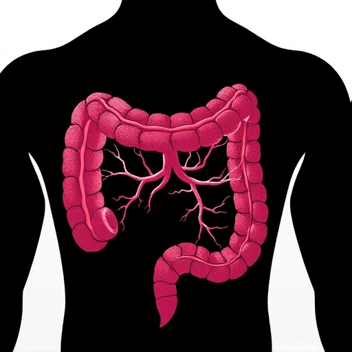 Targeting Nudt21 Cuts Colorectal Cancer Spread 1778057980