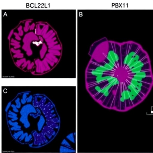 Targeting Pbx1–Bcl2L1 Axis In Colorectal Cancer Therapy 1777996650