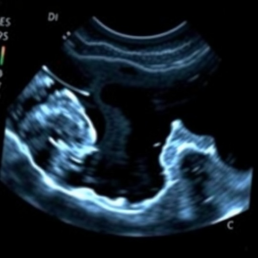 Ultrasound Measures Muscle Size In Preterm Infants 1779885152