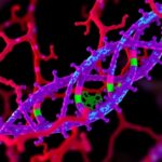 Aoc1 Controls Labor Via Spermidine Driven Autophagy 1782117392