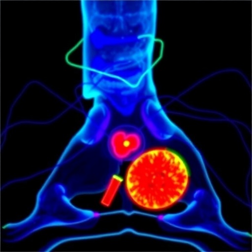Active Β Catenin Drives Aggressiveness In Pediatric Osteosarcoma Study Finds 1781028447