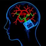 Antler Stem Cells Relieve Cerebral Ischemic Injury 1782321096