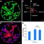 B7X Promotes Resistance To Pd 1Pd L1 Blockade In Bladder Cancer 1780941756