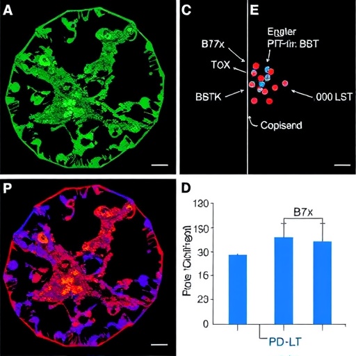 B7X Promotes Resistance To Pd 1Pd L1 Blockade In Bladder Cancer 1780941756