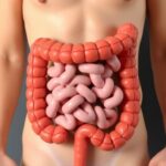 Bmi Chemotherapy Toxicity Survival In Colorectal Cancer 1781059051