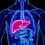 Can Immunotherapy Increase Liver Cancer Patients8217 Eligibility For Transplantation 1782186511