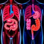 Comparing Organ Preserving And Radical Surgery Approaches For Ureteral Urothelial Carcinoma 1781278050