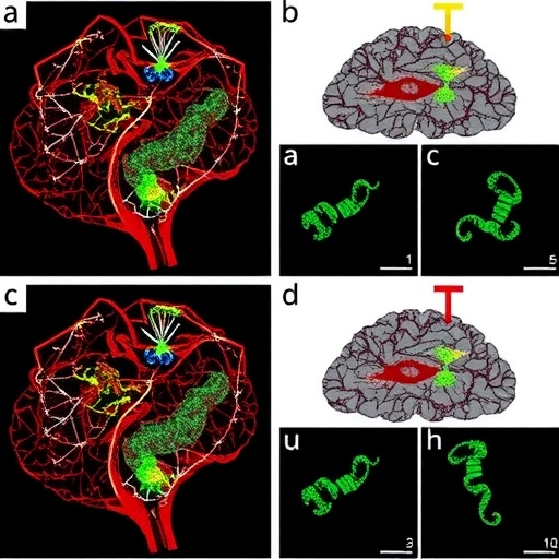 Dietary Changes Remodel Chromatin Structure And Prolong Survival In Glioma Models 1781125523