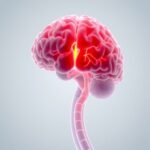 Elderly Brain Avm Treatment And Outcomes Explored 1781531729