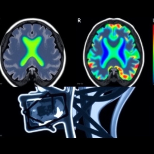 Enhancing Cns Tumor Therapy With Mri Guided Ultrasound 1781565091