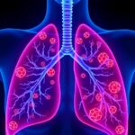Gpr84 Drives Lung Inflammation Via Zbp1 Panoptosome Activation 1781414065