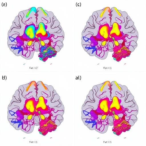 Genetic And Cell State Evolution In Idh Gliomas 1780507289