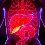 Immune Metabolite Itaconate Drives Stills Disease Liver Damage 1780697545